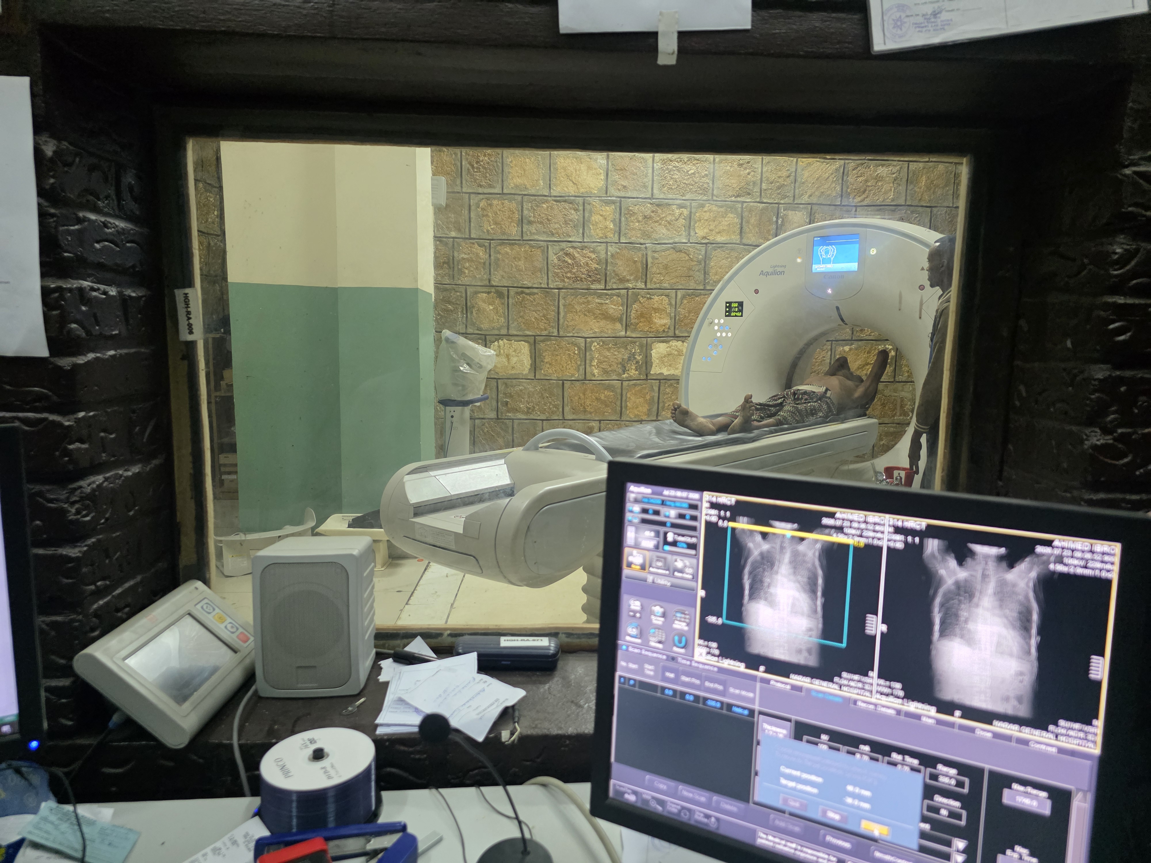 CT Scanner